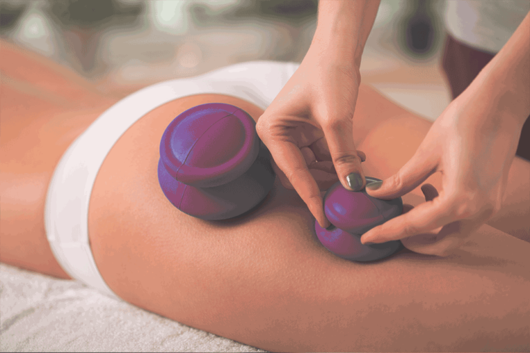 Masaż bańkami chińskimi i próżniowymi